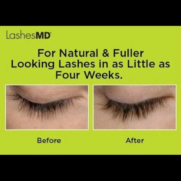 🌸 Lashes MD -Professional Grade Eyelash Growth Serum🌸 - Picture 11 of 11